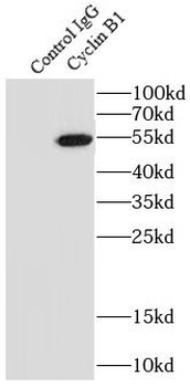 CCNB1 Rabbit Polyclonal Antibody
