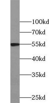 CCNB1 Rabbit Polyclonal Antibody