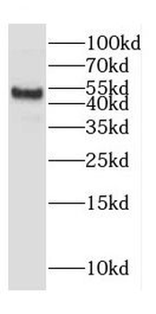 CYP11A1 Rabbit Polyclonal Antibody