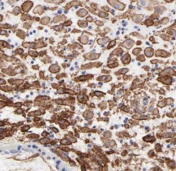 CYP11A1 Rabbit Polyclonal Antibody