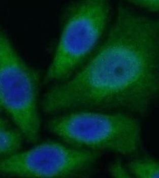 CYP11B2 Antibody