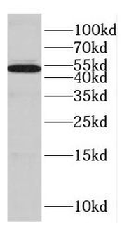 CYP17A1 Rabbit Polyclonal Antibody