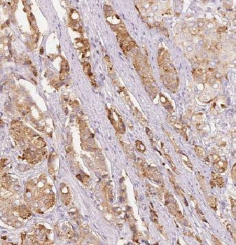 CYP17A1 Rabbit Polyclonal Antibody