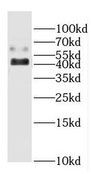 CYP20A1 Rabbit Polyclonal Antibody