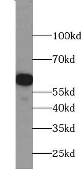 CYP24A1 Rabbit Polyclonal Antibody