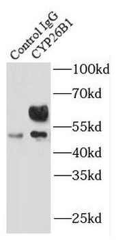 CYP26B1 Antibody