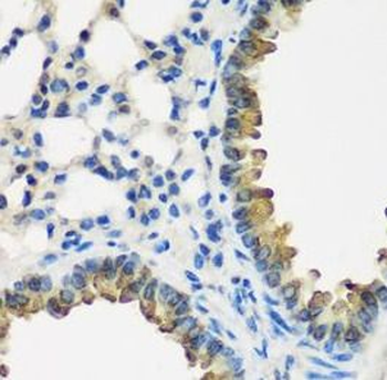 CYP2F1 Rabbit Polyclonal Antibody