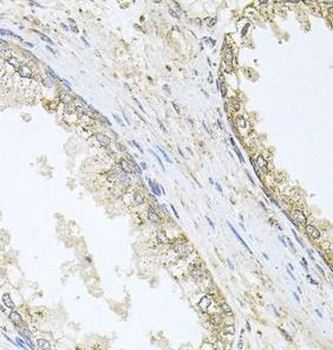 CYP46A1 Rabbit Polyclonal Antibody