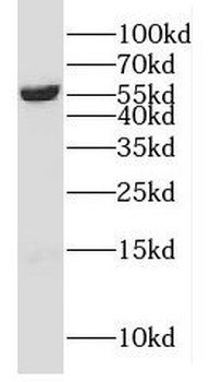 CYP4F11 Rabbit Polyclonal Antibody
