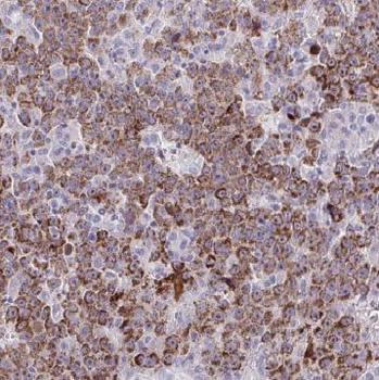 CYP4F11 Rabbit Polyclonal Antibody