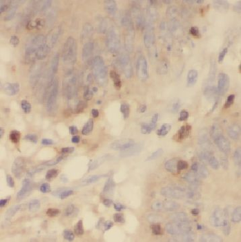CYP4F12 Rabbit Polyclonal Antibody