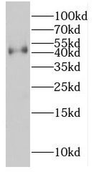 MT-CYB Antibody