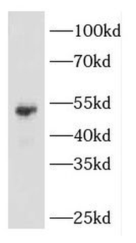 KRT14 Rabbit Polyclonal Antibody