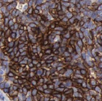 KRT14 Rabbit Polyclonal Antibody