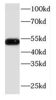 KRT14 Rabbit Polyclonal Antibody