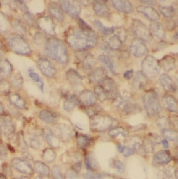 KRT14 Rabbit Polyclonal Antibody