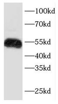 KRT7 Rabbit Polyclonal Antibody