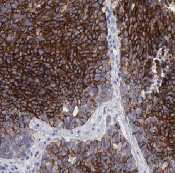 KRT7 Rabbit Polyclonal Antibody