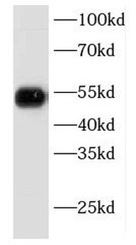 KRT8 Rabbit Polyclonal Antibody
