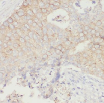 KRT8 Rabbit Polyclonal Antibody