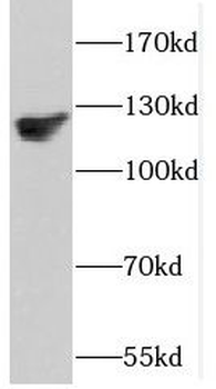 DAAM1 Rabbit Polyclonal Antibody