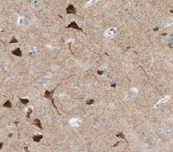 DAAM1 Rabbit Polyclonal Antibody