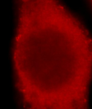 DAB2 Antibody