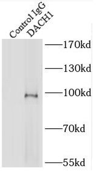 DACH1 Rabbit Polyclonal Antibody