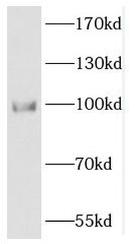DACH1 Rabbit Polyclonal Antibody