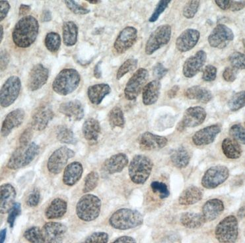 DACH1 Rabbit Polyclonal Antibody