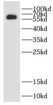 TKFC Rabbit Polyclonal Antibody