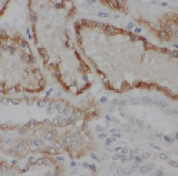 ACKR1 Rabbit Polyclonal Antibody