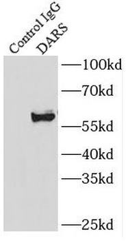 DARS1 Antibody