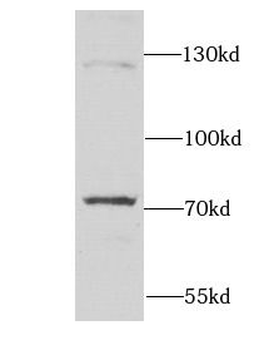 DARS2 Antibody
