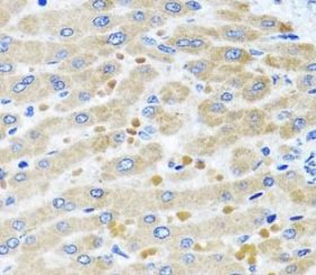 DARS2 Rabbit Polyclonal Antibody