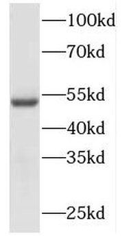 DBT Antibody