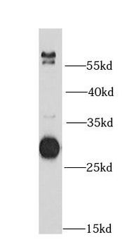 DCK Rabbit Polyclonal Antibody