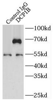 DCP1B Antibody