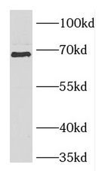 DCP1B Rabbit Polyclonal Antibody