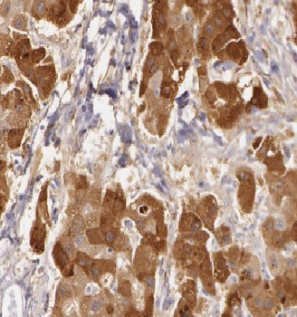 DCP1B Rabbit Polyclonal Antibody