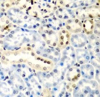 DCTD Rabbit Polyclonal Antibody