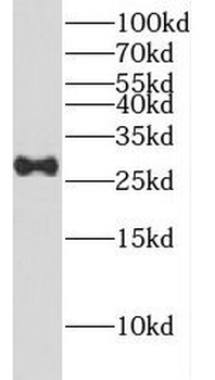 DCTN6 Rabbit Polyclonal Antibody