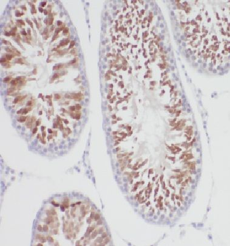 DCTN6 Rabbit Polyclonal Antibody