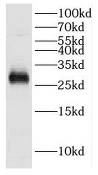 DCUN1D5 Rabbit Polyclonal Antibody