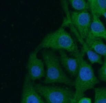 DCX Antibody