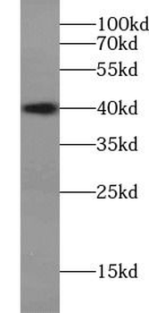 DCX Rabbit Polyclonal Antibody