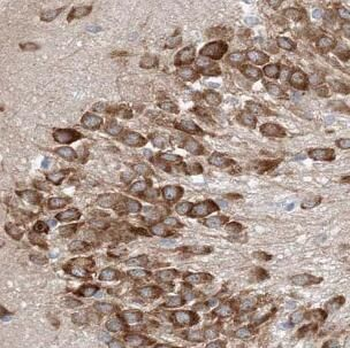 DCX Rabbit Polyclonal Antibody