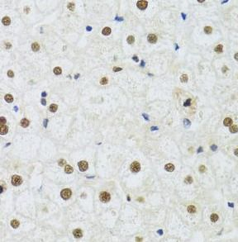 DDB1 Rabbit Polyclonal Antibody
