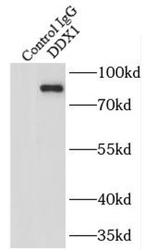 DDX1 Rabbit Polyclonal Antibody