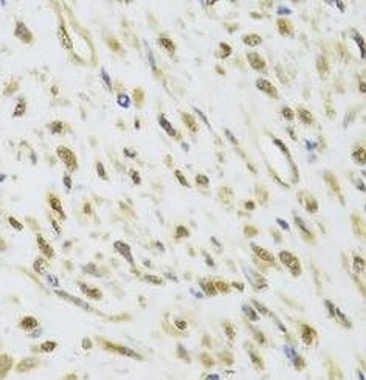 DDX1 Rabbit Polyclonal Antibody